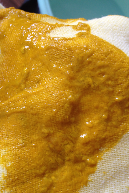 半个月的婴儿拉肚子怎么办 半个月的婴儿拉肚子怎么办较快的方法小妙招