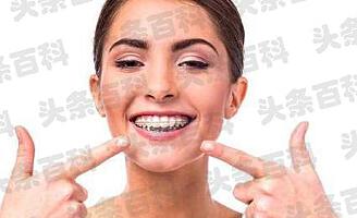 牙套佩戴视频__牙套的视频给我看看