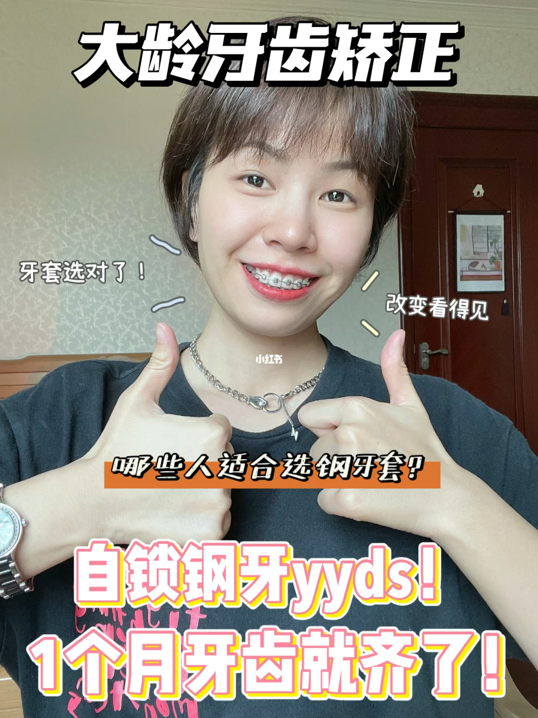 牙套佩戴视频_牙套的视频给我看看_